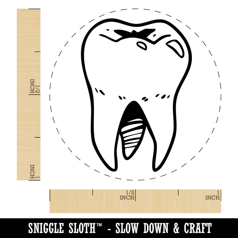Realistic Tooth Molar Sparkling Clean Dental Self-Inking Rubber Stamp for Stamping Crafting Planners