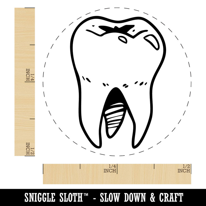 Realistic Tooth Molar Sparkling Clean Dental Self-Inking Rubber Stamp for Stamping Crafting Planners