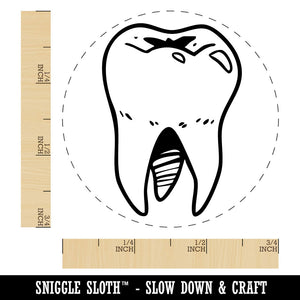 Realistic Tooth Molar Sparkling Clean Dental Self-Inking Rubber Stamp for Stamping Crafting Planners