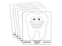 Tooth Wearing Braces